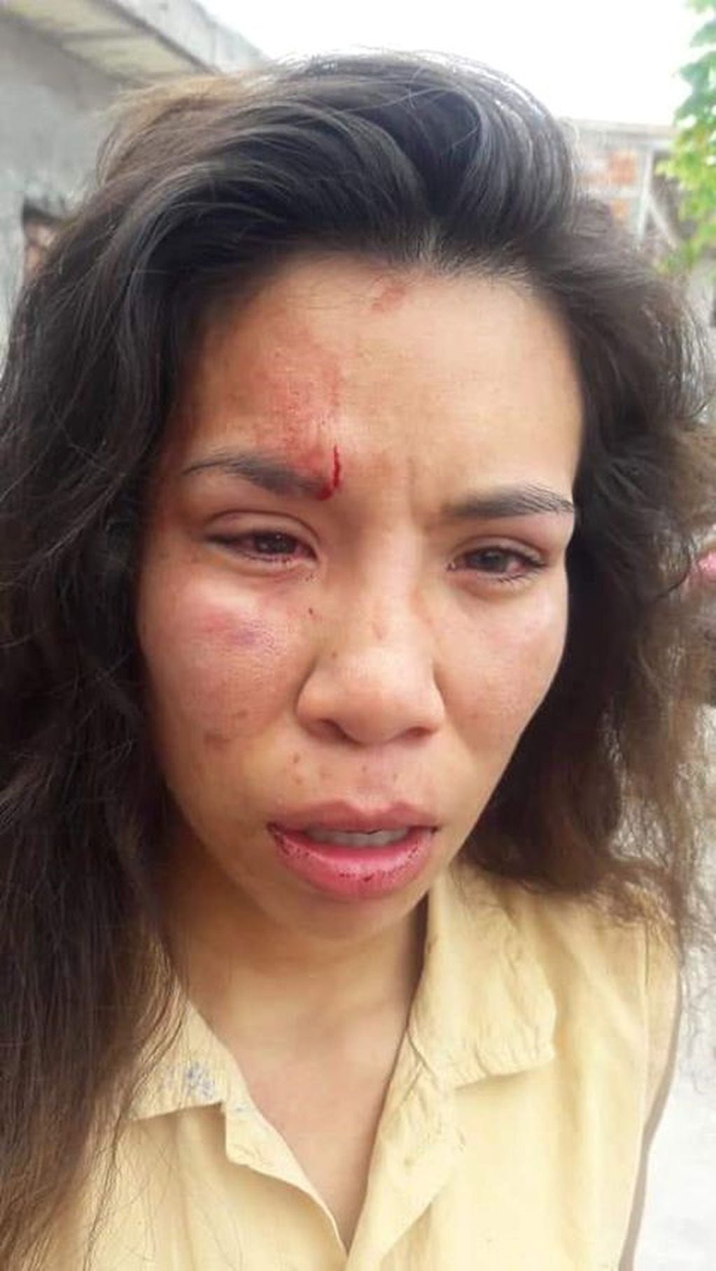 Micaela, víctima de un ataque callejero. (Web)