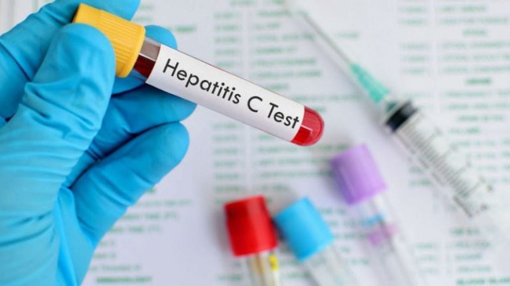 Lanzan campaña de detección de Hepatitis C