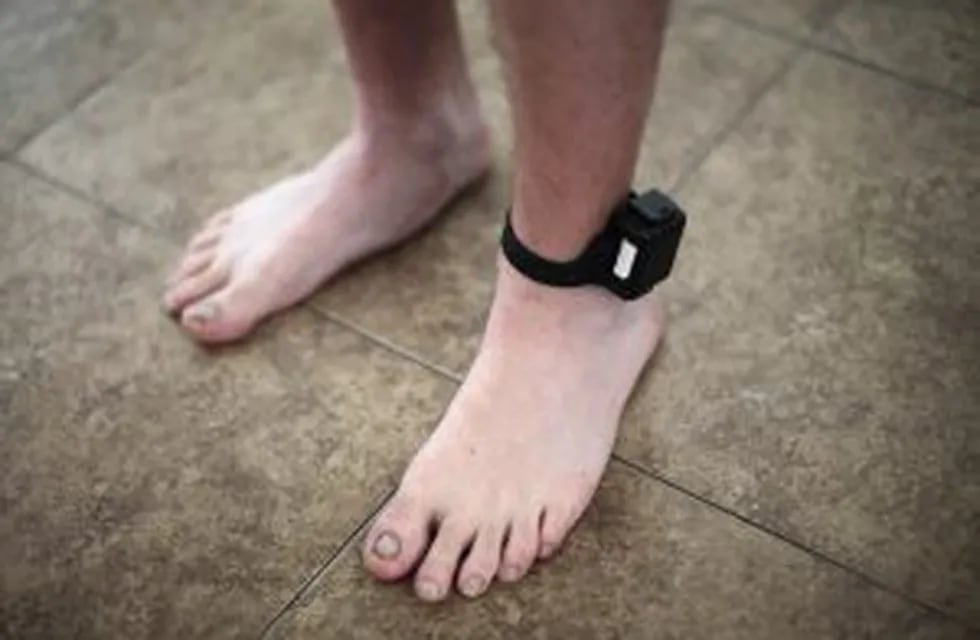 A probationer wears an ankle tracking device in Santa Ana, California July 22, 2011. The Supreme Court has ordered California to release more than 30,000 inmates over the next two years or take other steps to ease overcrowding in its prisons to prevent 