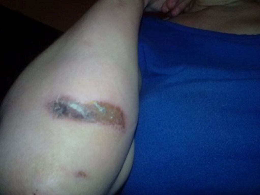 Una mujer fue violentamente atacada por un motochorro
