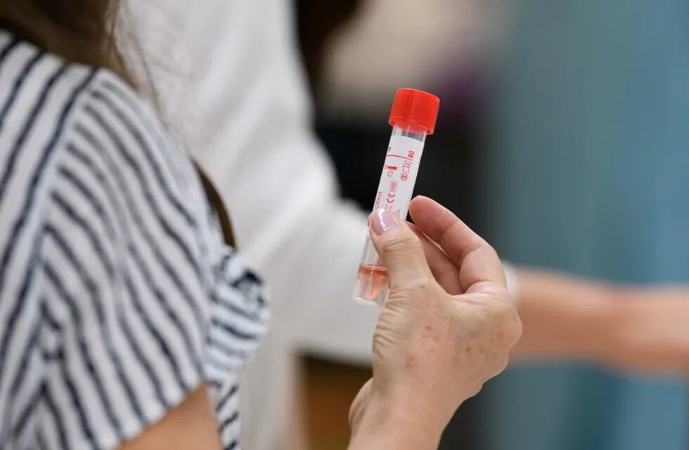 An arrival passenger holds a vial containing a swab sample to be tested for Covid-19 at a polymerase chain reaction (PCR) testing site inside Narita Airport in Narita, Chiba Prefecture, Japan, on Sunday, July 19, 2020. More Japanese people are discontent with the government’s response to the coronavirus pandemic now compared with a month ago as infections in the country increase, a poll showed. Photographer: Akio Kon/Bloomberg