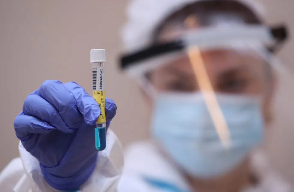 A member of the medical personnel shows a PCR test for the coronavirus disease (COVID-19) at a COVID-19 testing center at Saint-Jean Clinic in Brussels, Belgium October 14, 2020. REUTERS/Yves Herman