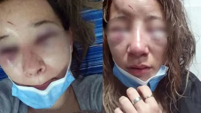 Una joven de 24 fue atacada brutalmente a la salida de un boliche.