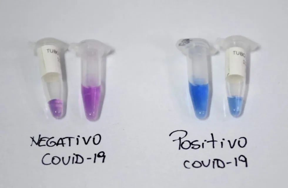 View of positive (R) and negative COVID-19 NEOKIT tests in Buenos Aires, on May 21, 2020. - The new COVID-19 NEOKIT, developed by Argentinian scientists, diagnoses the new coronavirus in less than two hours. (Photo by JUAN MABROMATA / AFP)