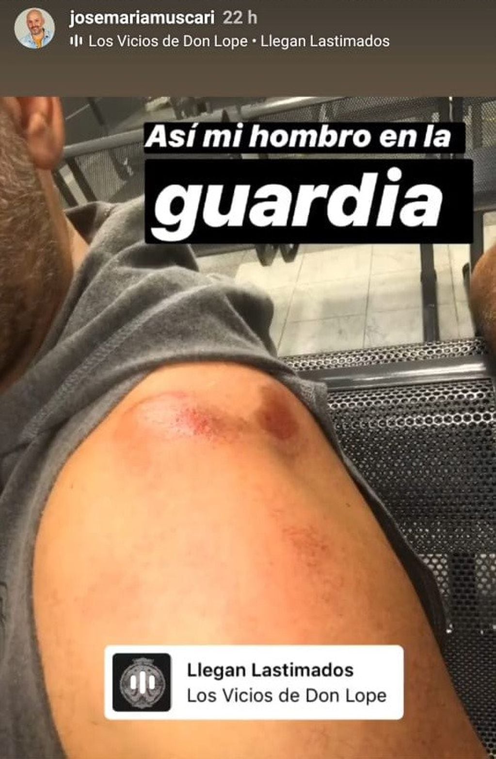 José María Muscari sufrió un accidente (Instagram)
