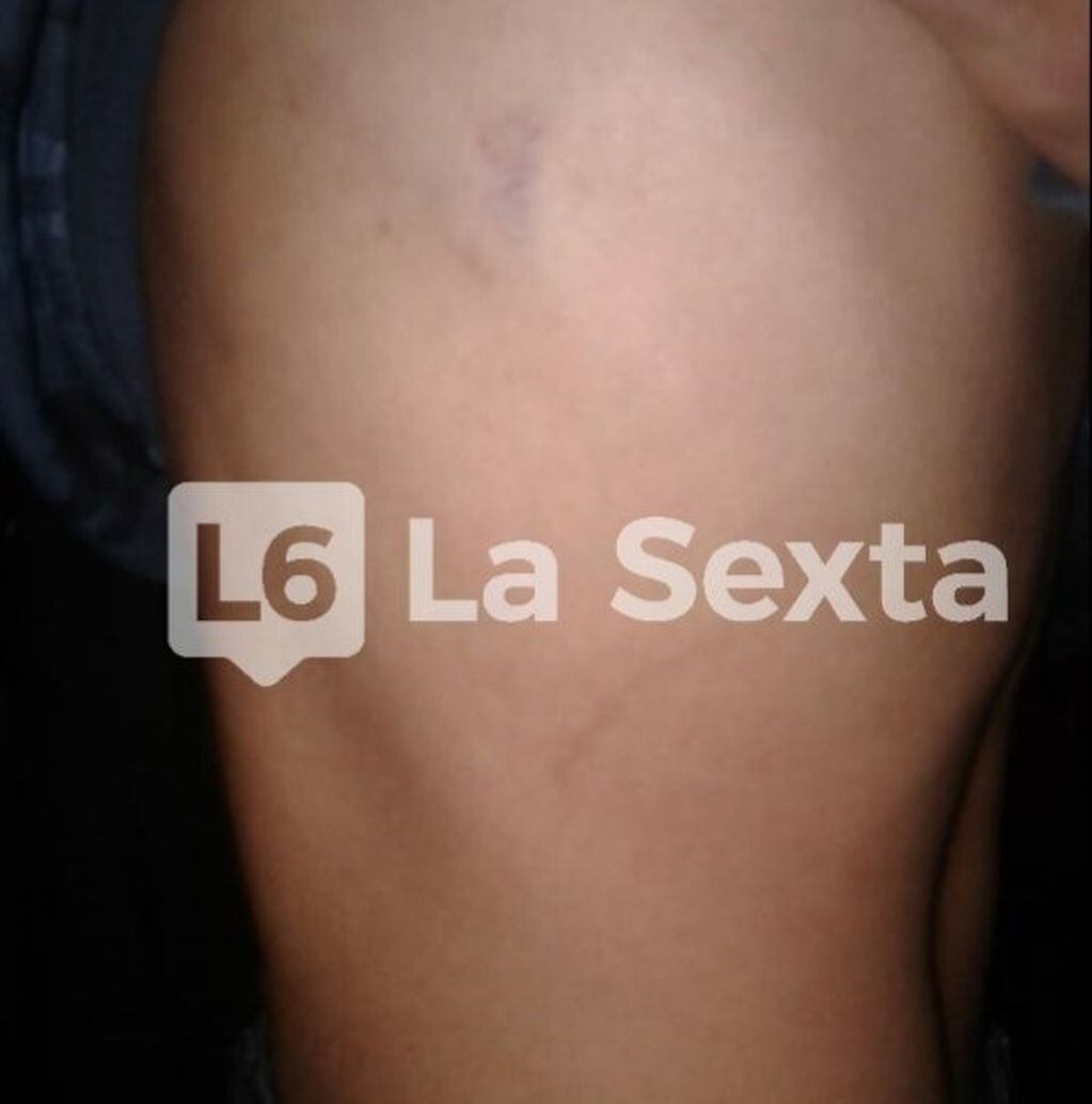 Violencia Policial en Santa Elena