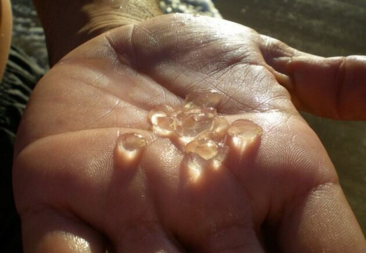 Qué hacer si te pica una tapioca: alerta por su presencia en la Costa Atlántica thumbnail