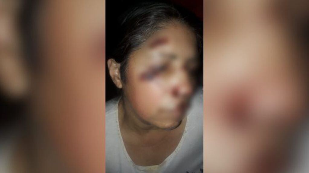 Detienen a dos hombres acusados de agredir brutalmente a una mujer en Posadas.