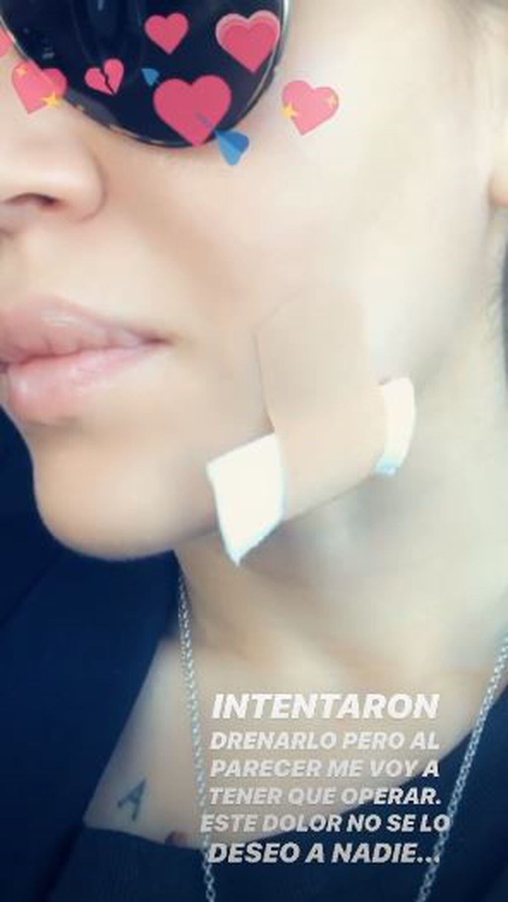 Jimena Barón habló sobre la infección de su cara (Instagram/jmena)