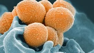 BACTERIA.  Streptococcus del Grupo A, en una imagen ilustrativa (National Institute of Allergy and Infectious Diseases vía AP).