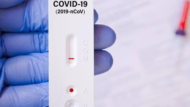 20 casos nuevos de Covid-19 en Pérez