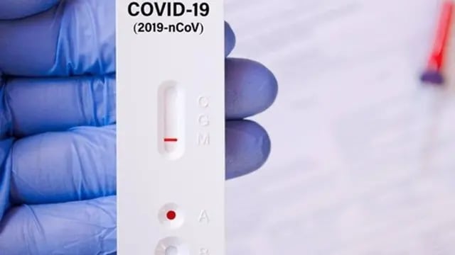 20 casos nuevos de Covid-19 en Pérez