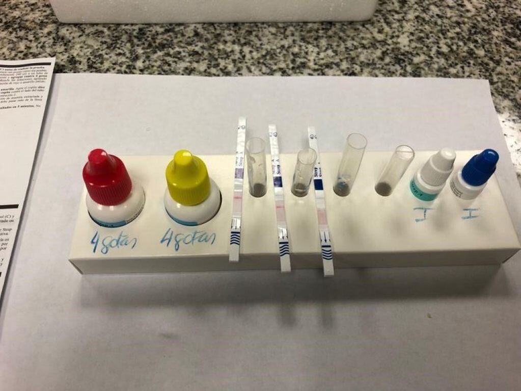 Streptococcus pyogene: los elementos necesarios para realizar el test