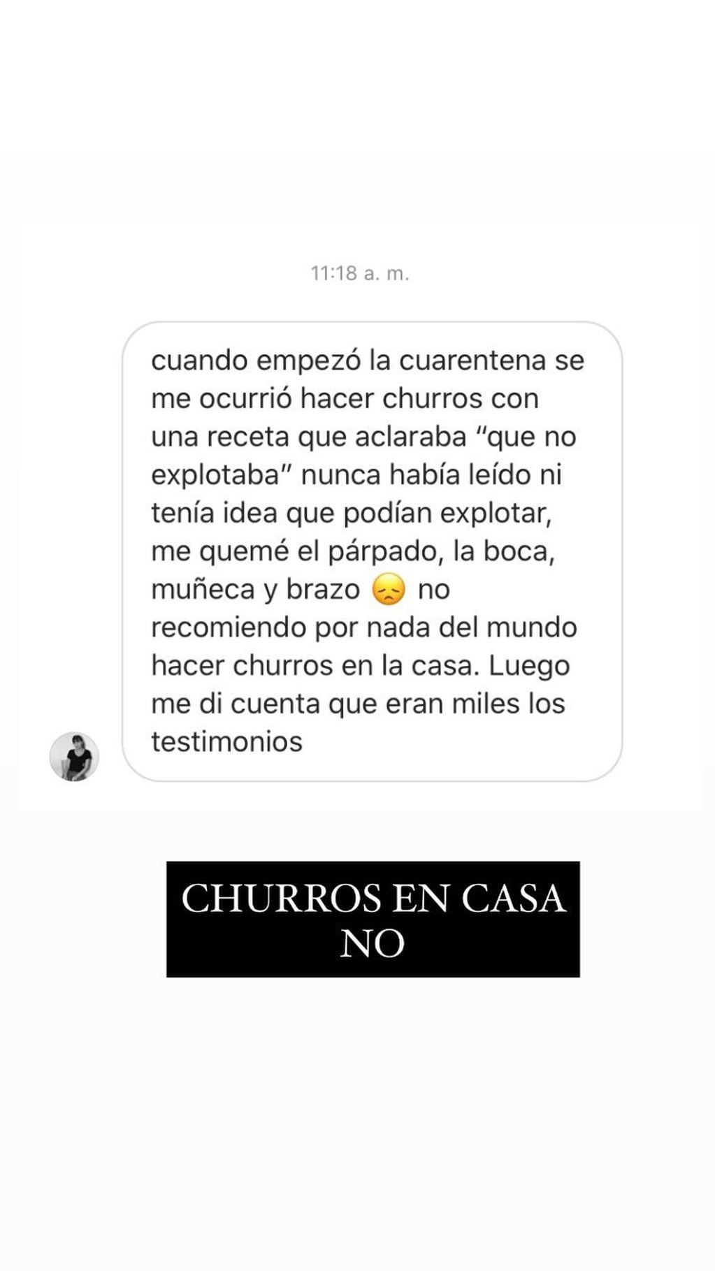 Quemaduras por hacer churros caseros (Gentileza Bromatología en Casa- Instagram).