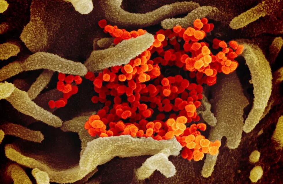 This image provided by The National Institute of Allergy and Infectious Diseases (NIAID). This scanning electron microscope image shows SARS-CoV-2 (orange)—also known as 2019-nCoV, the virus that causes COVID-19—isolated from a patient in the U.S., emerging from the surface of cells (green) cultured in the lab. (NIAID-RML via AP)