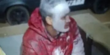 Insólito: se pintó la cara para no ser reconocido y terminó detenido por robo