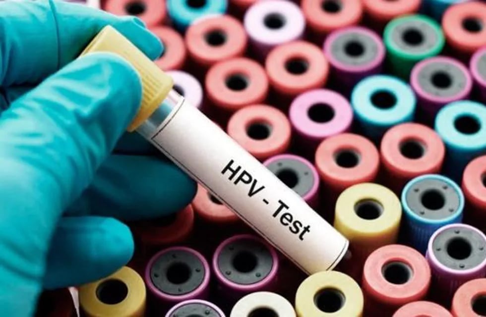 El HPV causa numerosas enfermedades.