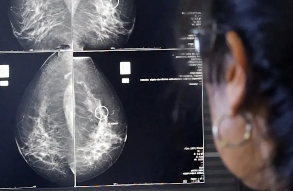 Con la cobertura del Programa de Control de Cáncer de Mama, en el último año se incrementó un 50% la cantidad de mamografías realizadas en toda la provincia, llegando a un total de 5.600 estudios solo en el ámbito público.