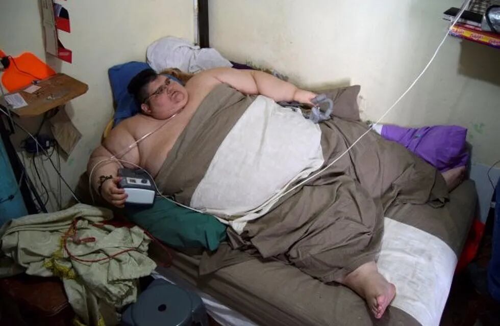 Juan Pedro Franco Salas, el hombre más obeso del mundo.