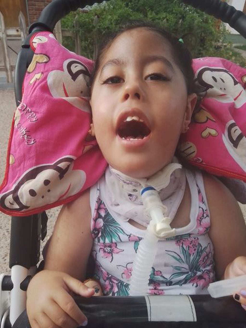 La pequeña Giana de tres años sufre una rara enfermedad muscular. Tiene internación domiciliaria y está conectada a un respirador.
