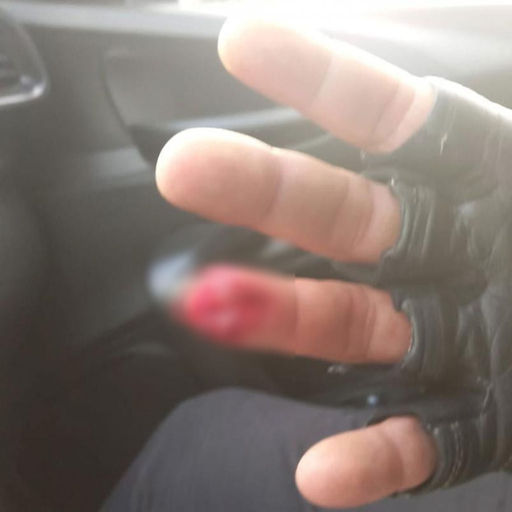 Deán Funes. El agresor mordió al oficial, ocasionándole la amputación de la tercera falange del dedo anular.