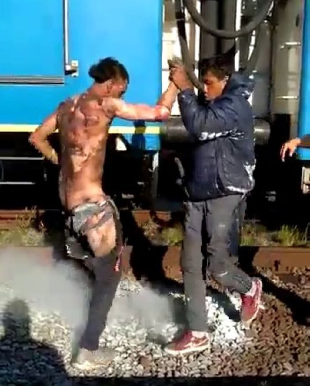 Así quedó uno de los electrocutados en el tren Roca.