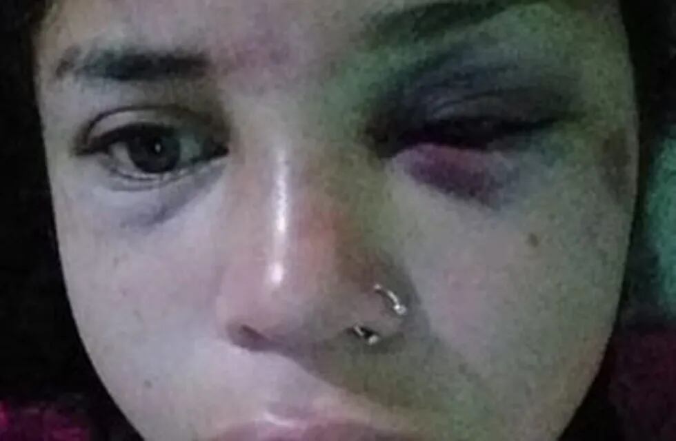 María Belén fue brutalmente atacada por su ex pareja delante de sus hijas y amenazada de muerte