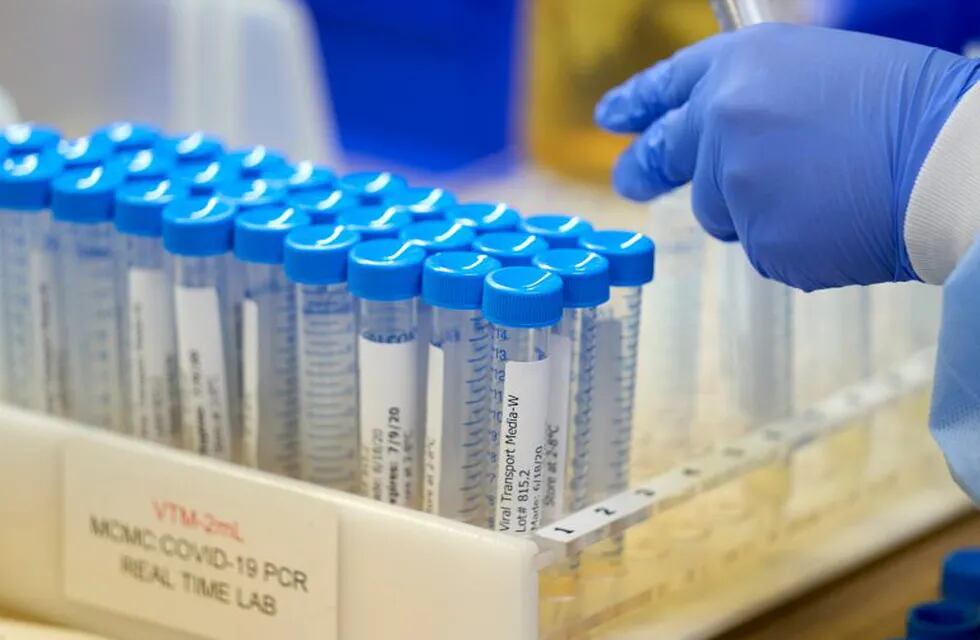 A lab at Methodist Dallas Medical Center prepares viral transport media for samples before collecting samples for coronavirus disease (COVID-19) in Dallas, Texas, U.S. June 24, 2020.    REUTERS/Cooper Neill     TPX IMAGES OF THE DAY