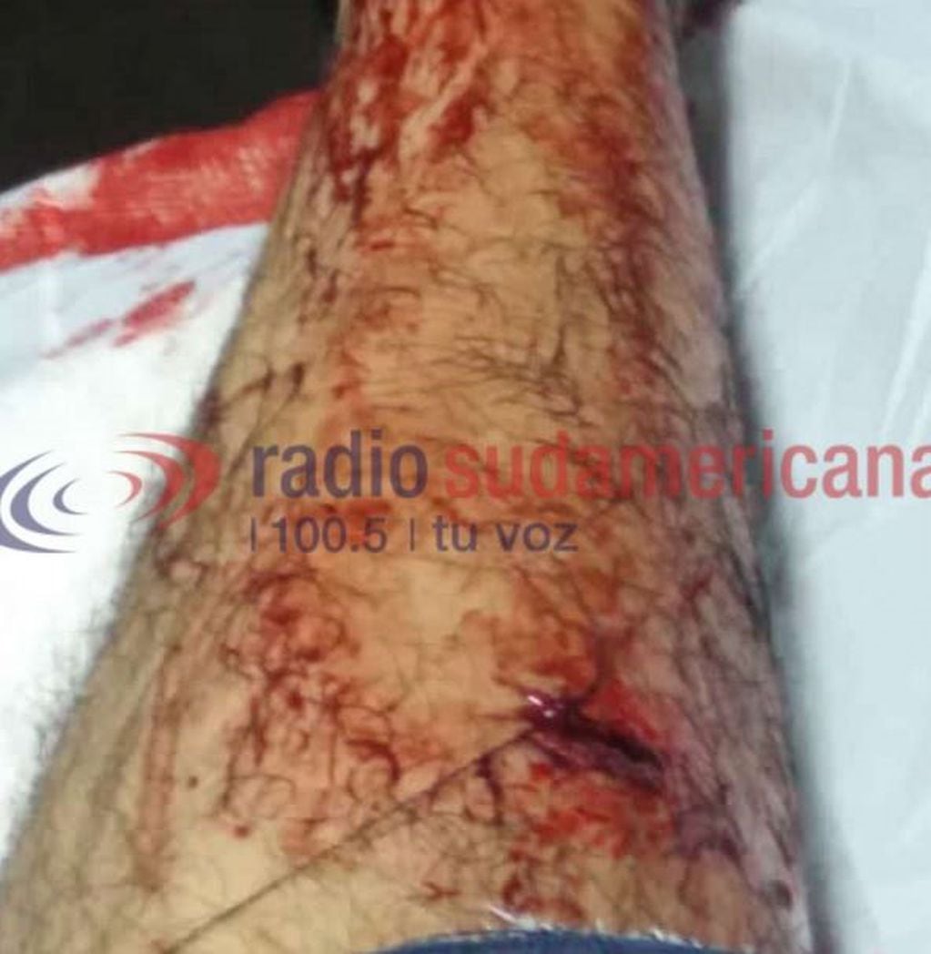 El joven recibió un disparo en la pierna. (Foto: Radio Sudamericana)