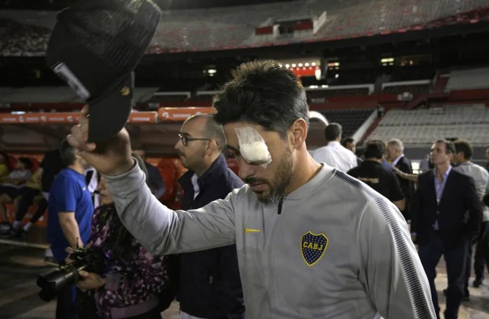 Pablo Pérez en el Monumental, con su ojo izquierdo vendado (AFP)