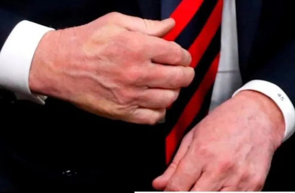 La mano de Trump
