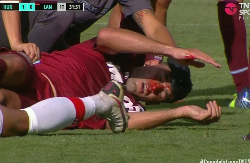Fuerte choque de cabeza entre Candia y Braghieri, que termina con el jugador de Lanús inconsciente. / Gentileza.