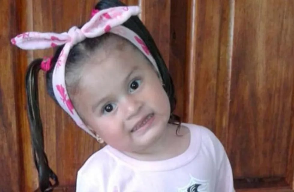 Ana Bella, la pequeña de tres años a la cual debieron amputarle las piernitas en el Hospital de Niños de Córdoba. Sus papás piden ayuda.