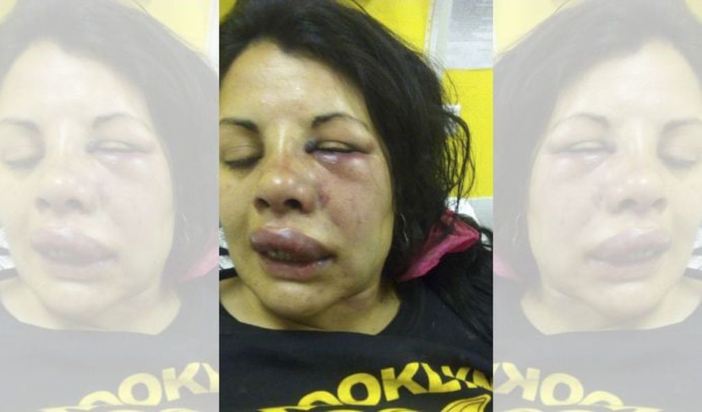 La mujer sufrió una terrible golpiza por parte de su pareja. Foto: El Corredor de Noticias.
