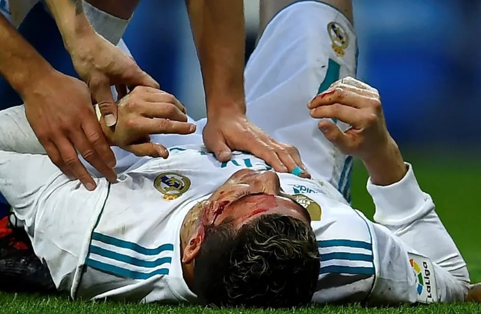 Así le quedó la cara a Cristiano Ronaldo tras el patadón. Foto: AFP.