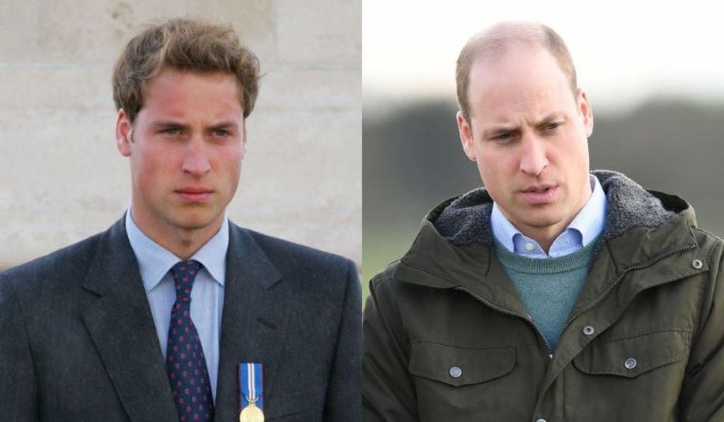 El futuro rey de Reino Unido fue elegido el calvo más lindo del mundo.