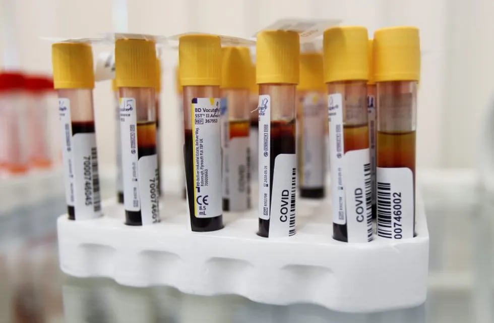 Vials with blood samples are pictured at a clinic providing testing for the coronavirus disease (COVID-19) and antibodies, after authorities launched free mass screening for residents in the Russian capital, in Moscow, Russia May 15, 2020. REUTERS/Maxim Shemetov?