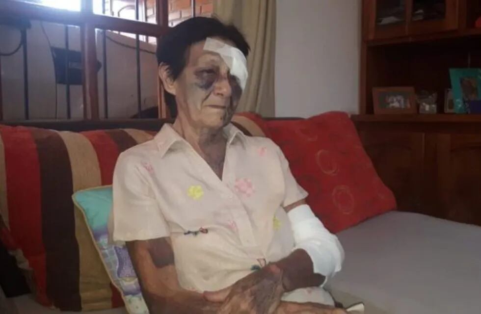 Colonia Victoria: golpearon salvajemente a una anciana de 77 años