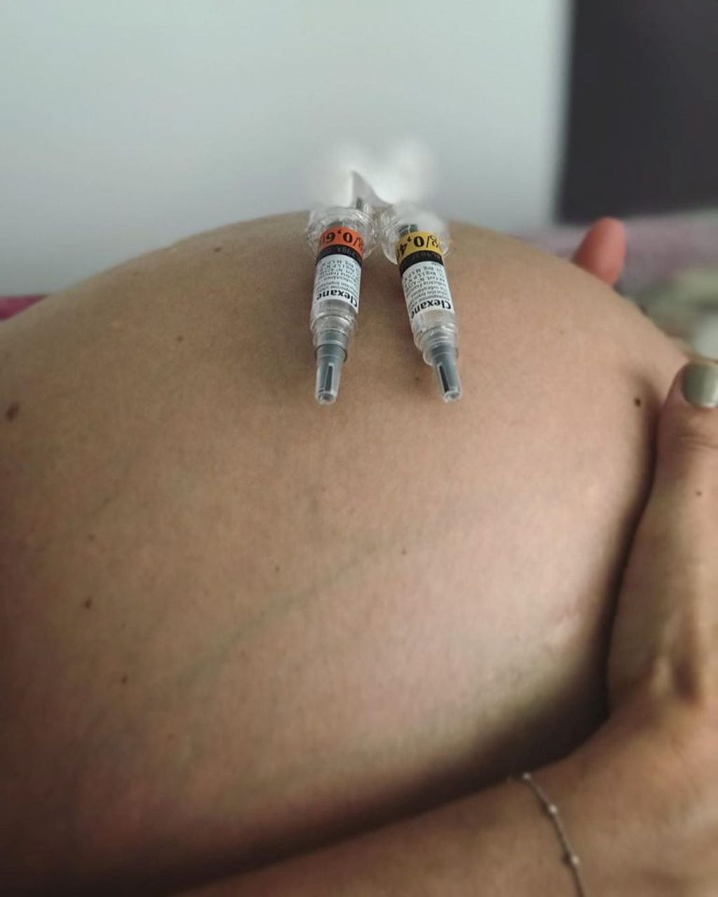 Eugenia Tobal tuvo 265 inyecciones durante su embarazo por la trombofilia (Foto: Instagram/ @eugeniatobal)