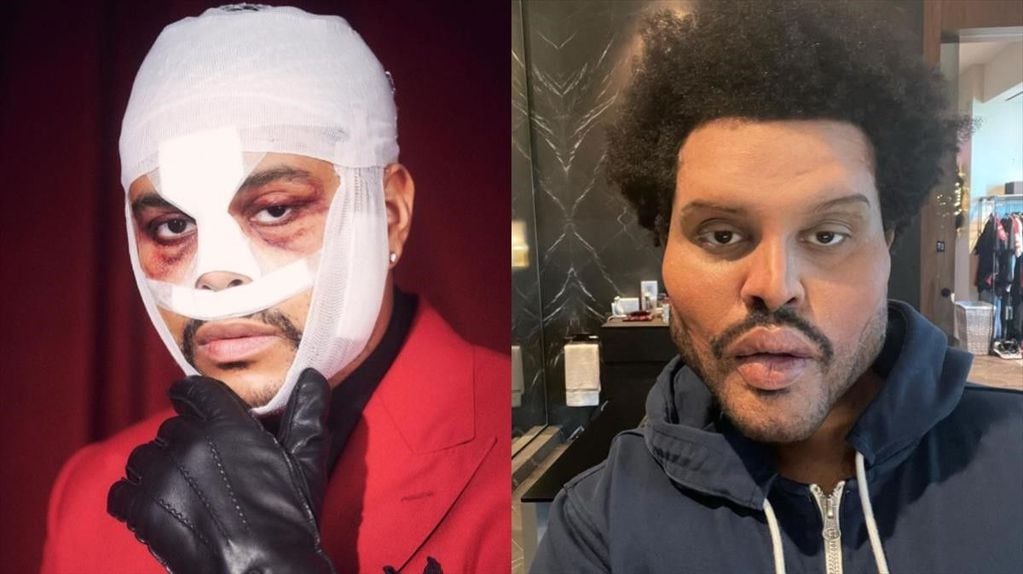 The Weeknd y sus retoques de alto impacto en el video 'Save your tears'