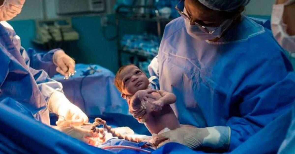 La Foto De Una Bebe Enojada Que Se Hizo Viral A Pocos Segundos De Haber Nacido Rumbos