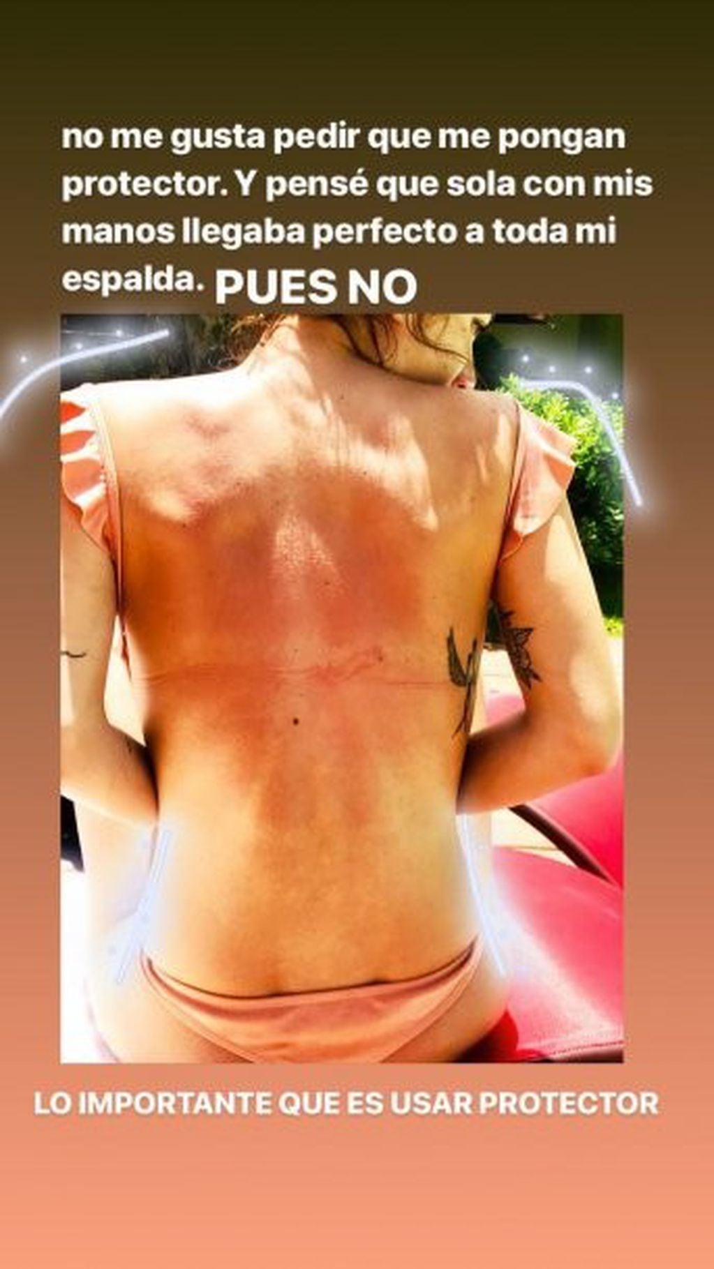 Gimena Accardi mostró cómo le quedó la espalda después de exponerse al sol sin protección
