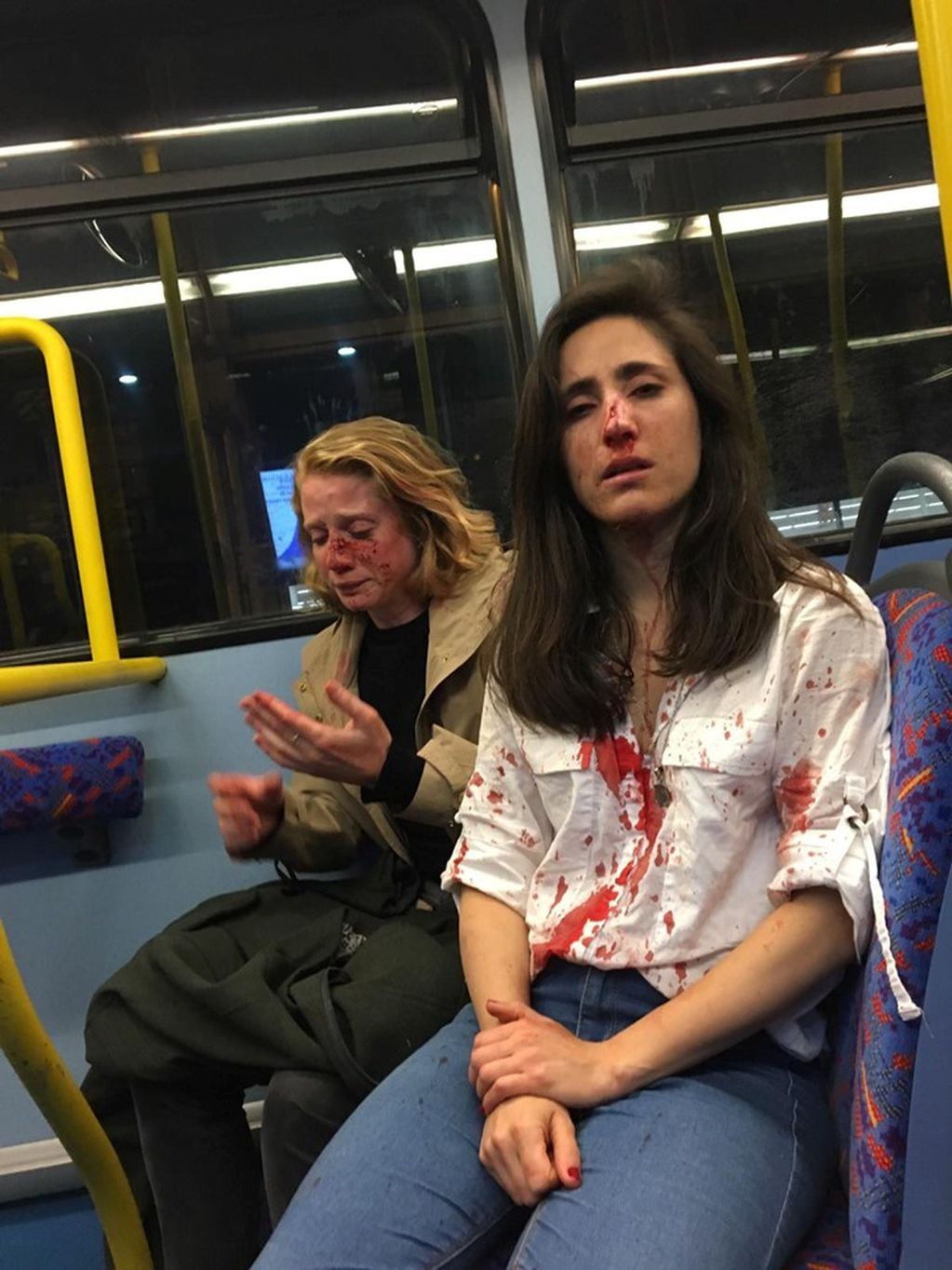 Un grupo de homofóbicos golpeó brutalmente a una pareja de mujeres en Londres (Foto: Facebook)