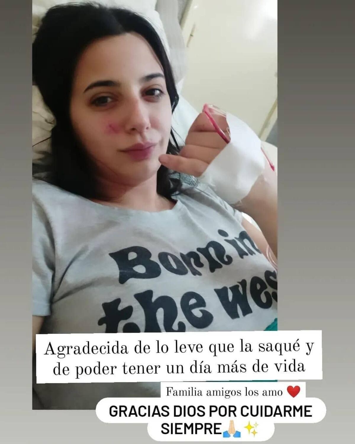 Fue atropellada en Mar del Plata y necesita conseguir 80 mil pesos para no perder su pierna