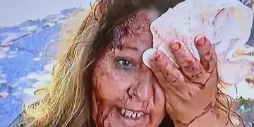 Mujer con el rostro destrozado por culatazos de delincuentes
