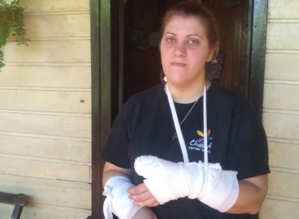 Dos mujeres fueron brutalmente atacadas por un pitbull. (Foto: Misiones Online)