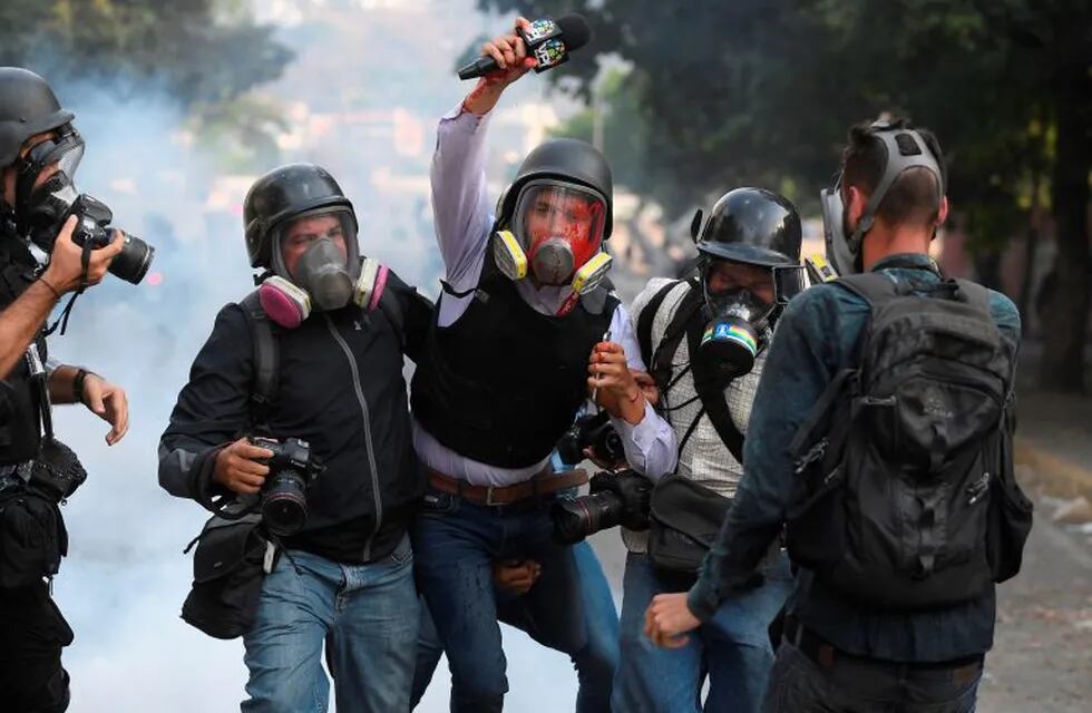 TOPSHOT - Venezuelan VPITV journalist Gregory Jaimes (C) is assisted by colleagues after being injured during clashes between anti-government protesters and security forces on the commemoration of May Day on May 1, 2019, after a day of violent clashes on the streets of the capital spurred by Venezuela's opposition leader Juan Guaido's call on the military to rise up against President Nicolas Maduro. - Guaido called for a massive May Day protest to increase the pressure on Venezuelan President Nicolas Maduro. (Photo by Federico Parra / AFP)