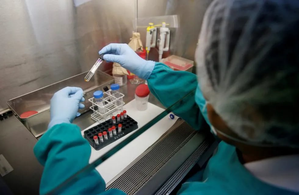 A health technician analyses blood samples for tuberculosis testing in a high-tech tuberculosis lab in Carabayllo in Lima, Peru May 19, 2016. REUTERS/Mariana Bazo SEARCH \
