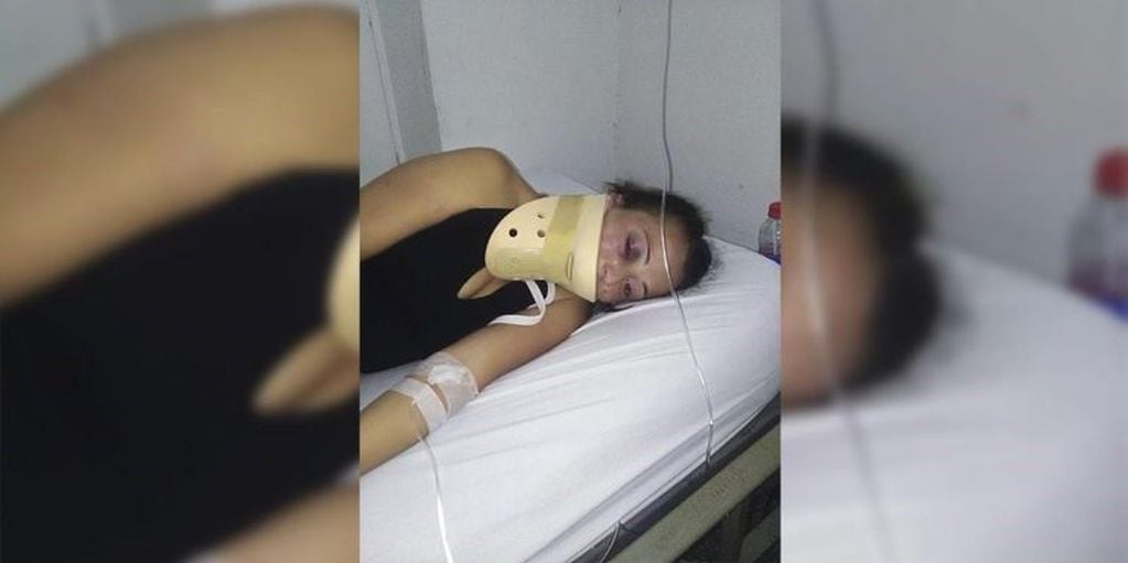 "Trate de defenderme pero no pude", comentó la joven agredida por una boxeadora en La Plata