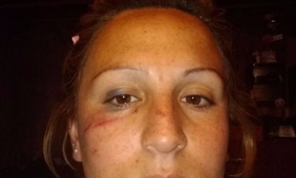 Antonella Gatica recibió dos trompadas en la cara.